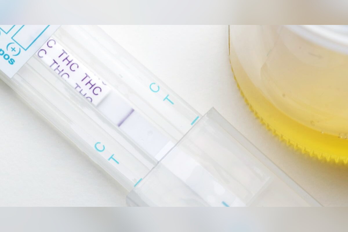 THC drug test strips next to a urine sample