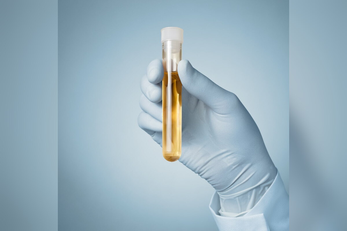 Gloved hand holding a test tube of urine sample