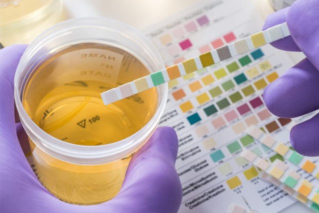 synthetic urine drug test