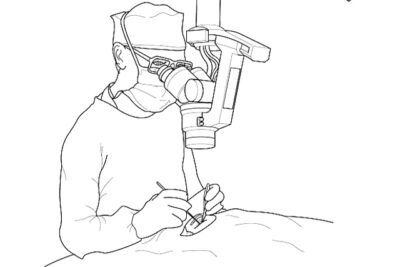 Deciding on a Vasectomy: What You Need to Know