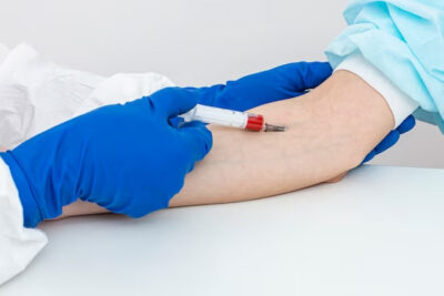 How Long to Fast Before Blood Tests