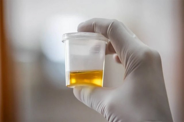 Kratom Urine drug Tests