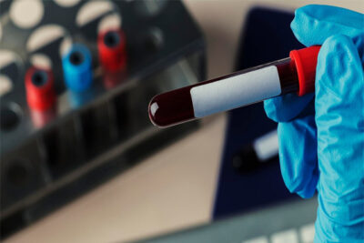 Comprehensive Guide to Blood Drug Tests
